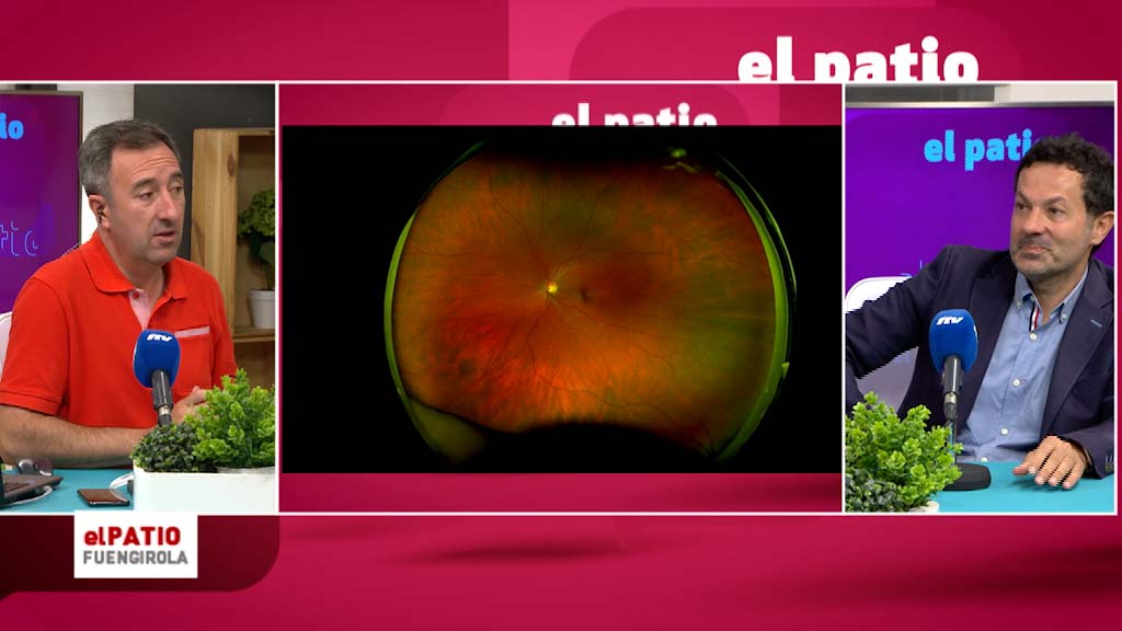 Lee más sobre el artículo Ojo a la retina