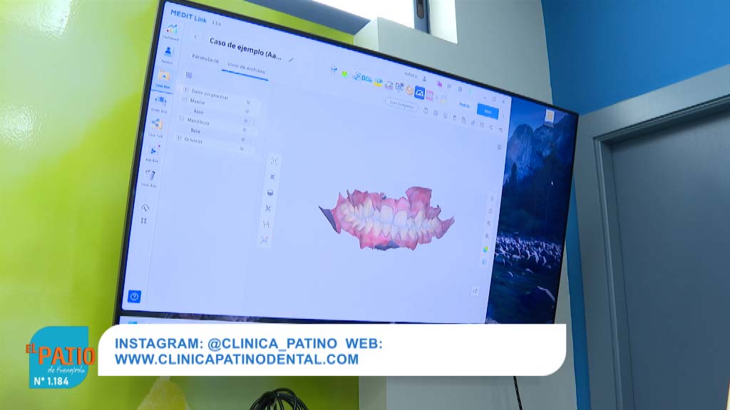 Lee más sobre el artículo Clínica Dental Patino