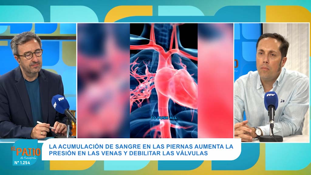 Lee más sobre el artículo Diagnóstico y tratamiento de varices